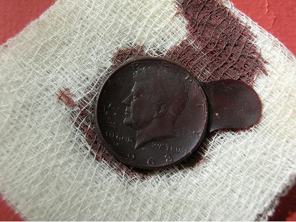 A picture of a Kennedy half dollar cast with blood and acrylic medium  by Stephen Kaltenbach