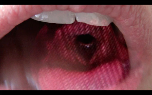 A photograph from a video by Claudia Borgna of an open mouth, teeth and throat